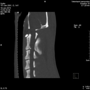 CT vyšetření krku vydry 2